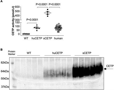 Expressing the Human Cholesteryl Ester Transfer Protein Minigene Improves Diet-Induced Fatty Liver and Insulin Resistance in Female Mice